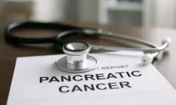 Ein Stethoskop liegt auf einem medizinischen Bericht auf einem Holztisch, mit Fokus auf dem Schriftzug „Pancreatic Cancer“.