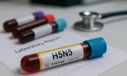 Blutröhrchen mit H5N5-Kennzeichnung auf einem Labordokument, im Hintergrund weitere Proben und ein Stethoskop.