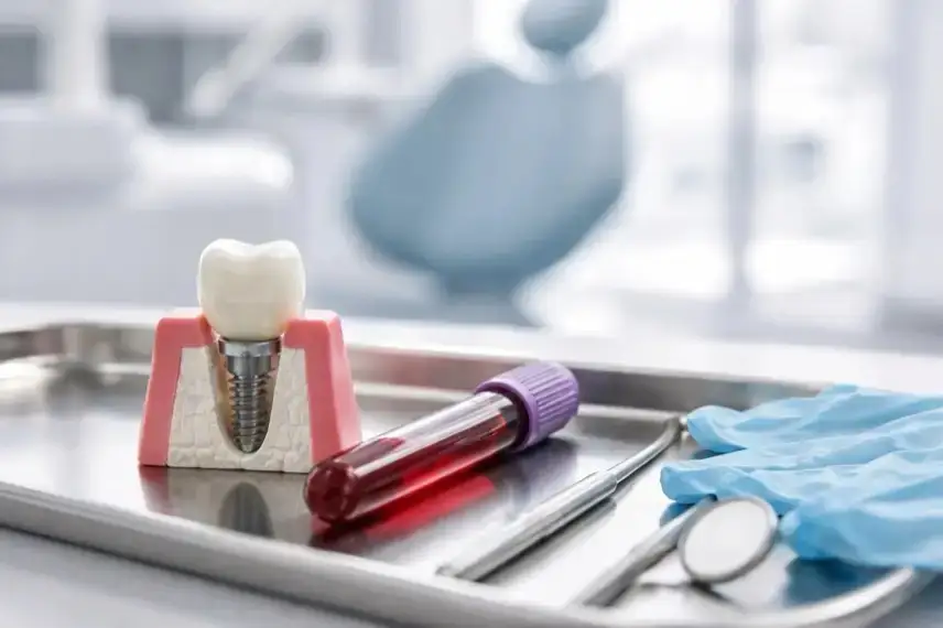 Zahnimplantat-Modell und Blutprobe im Behandlungsraum, Symbol für Vitamin D und Implantate